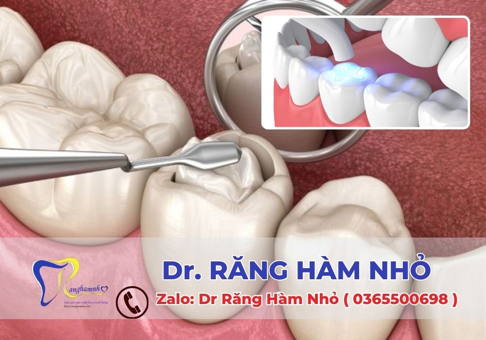 Hàn răng thẩm mỹ không chỉ phục hồi hình thể và chức năng của răng mà còn giúp bạn lấy lại sự tự tin trong giao tiếp hàng ngày.
