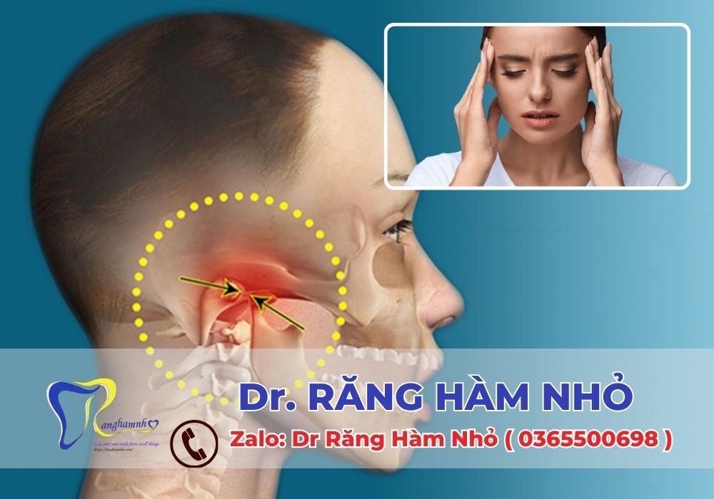 Nếu không được điều trị khớp hàm kịp thời, tình trạng có thể tiến triển mạn tính, gây biến dạng hàm, rối loạn cơ khớp và đau kéo dài.