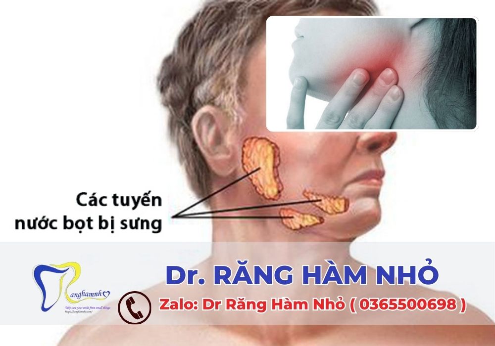 Với đội ngũ chuyên gia nhiều năm kinh nghiệm, thiết bị hiện đại và quy trình vô khuẩn nghiêm ngặt, Dr RĂNG HÀM NHỎ là nơi lý tưởng để khám và điều trị các bệnh lý về tuyến nước bọt.