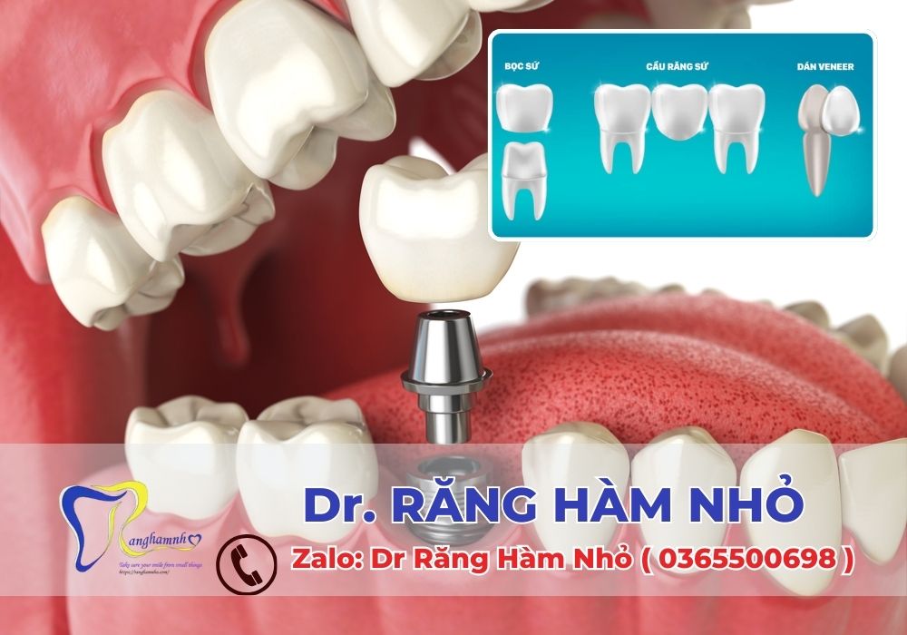 Dr RĂNG HÀM NHỎ là một trong những cơ sở nha khoa hàng đầu chuyên sâu về phục hình răng, cam kết mang lại dịch vụ tận tâm, hiện đại và chuẩn quốc tế.