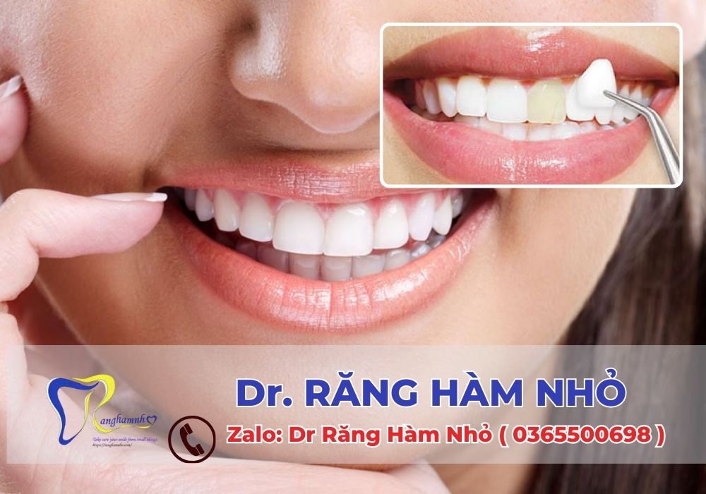 Dr RĂNG HÀM NHỎ là một trong những phòng khám chuyên về thẩm mỹ răng miệng với đội ngũ bác sĩ giàu kinh nghiệm và quy trình làm răng sứ an toàn, hiệu quả.