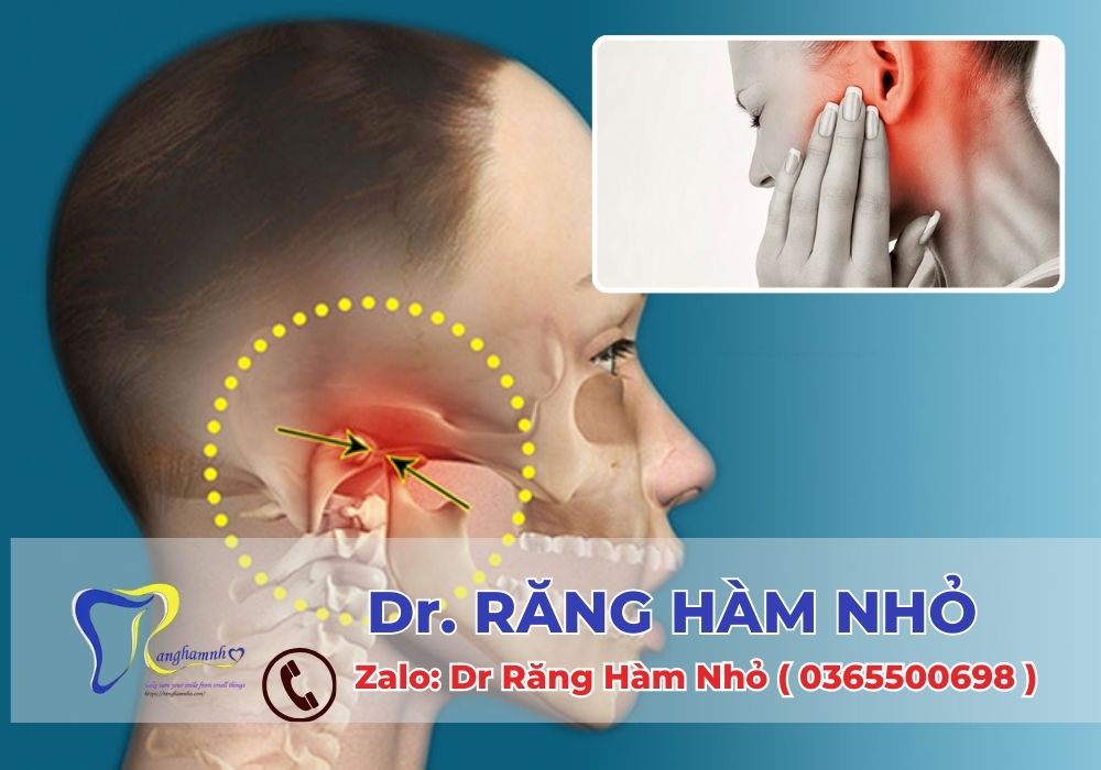 Đau khớp thái dương hàm là một vấn đề có thể gây đau đớn và ảnh hưởng nghiêm trọng đến chất lượng cuộc sống.