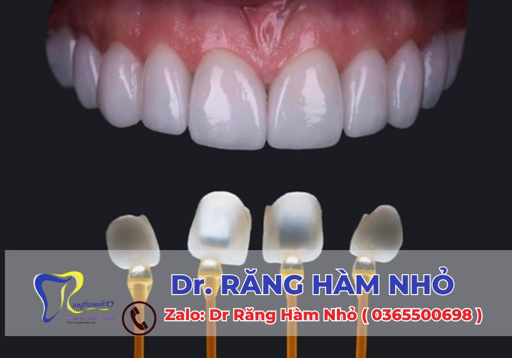 . Tại Dr RĂNG HÀM NHỎ, các kỹ thuật như dán sứ veneer, cầu răng sứ, răng sứ zirconia cũng đang được thực hiện với công nghệ cao, đảm bảo chất lượng, an toàn và thẩm mỹ tối ưu cho khách hàng.